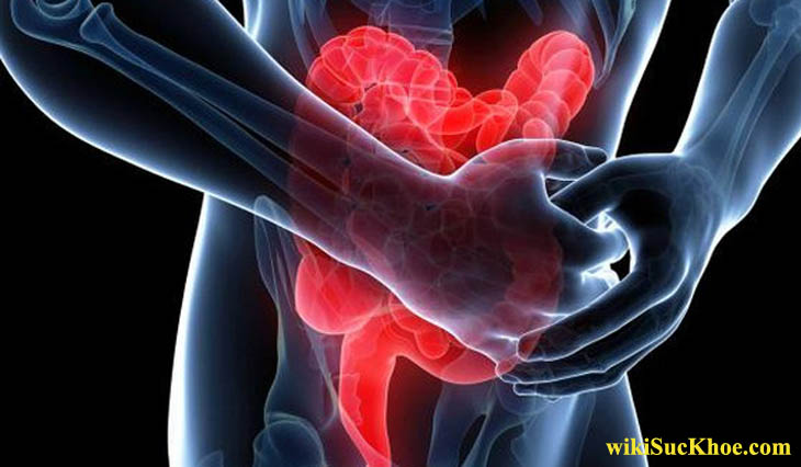 Bệnh viêm đường ruột vô cùng nguy hiểm